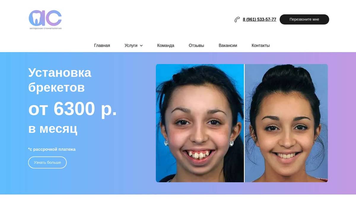 АС - Брекеты 1